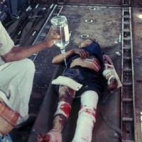 injured civilian